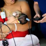 Hospital Regional do Gama passa a realizar exame para avaliação auditiva de recém-nascidos